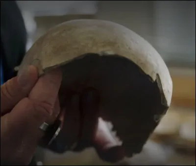 Dans ces fosses inhabituelles, utilisées pendant une cinquantaine d'années seulement, ces ossements reçoivent un traitement particulier, notamment les crânes. Qu'en pensent les paléo-anthropologues ?