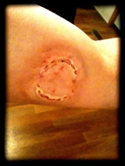 Ta camarade se fait mordre par un zombie.
Comment réagis-tu ?