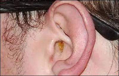Comment s'appelle la substance jaune et cireuse, qui joue un rôle de protection et de nettoyant de l'oreille ?