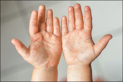 À quoi ça sert le savon ?