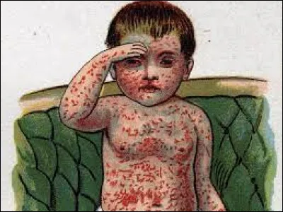 Que faut-il ajouter à "rou" pour obtenir le nom d'une maladie très contagieuse ?