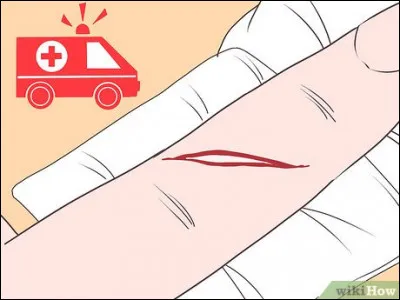 Finalement, vous décidez d'appeler les pompiers ; hélas plus de wifi, vous êtes obligé(e) de vous rendre vous-même à l'hôpital en sachant qu'il y en a pour 500 km à pied sans voiture. Quelle est votre réaction ?