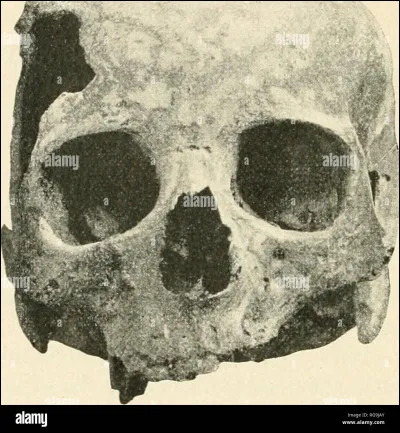 Quel est ton d&eacute;faut ?