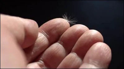 Qu'est-ce que la syndactylie ?