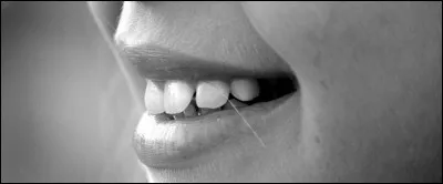 Comment traduirais-tu "mes dents" en anglais ?