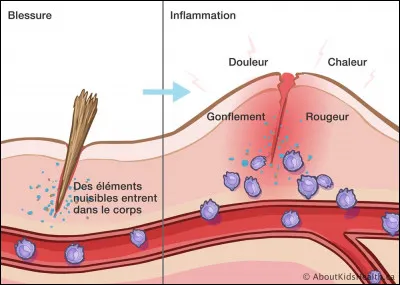 La fièvre, qui fait partie de la réaction inflammatoire (rougeur, chaleur, douleur, gonflement), est notamment sous le contrôle...