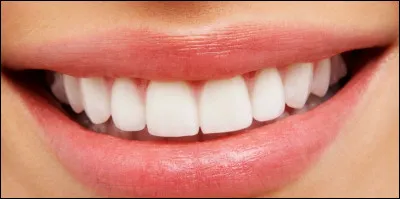 Combien de fois avez-vous eu des caries ou des problèmes dentaires ?