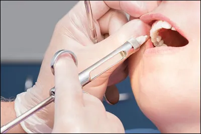 Quelle action détestes-tu chez le dentiste ?