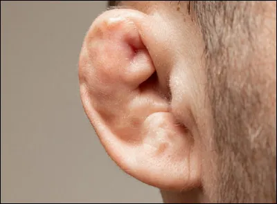 Quels sportifs ont parfois les oreilles en chou-fleur ?