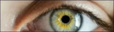As-tu la pupille diminuée ? (Comme sur la photo)