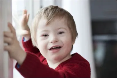 Au Brésil, combien d'heures de kinésithérapie est-il recommandé d'amener les bébés porteurs de trisomie 21 à faire, de façon à favoriser leur inclusion parmi les enfants non-porteurs à l'école plus tard ?