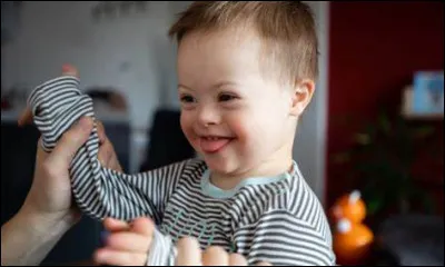 Laquelle de ces anomalies est désignée sous le terme de "syndrome de Klinefelter" ?