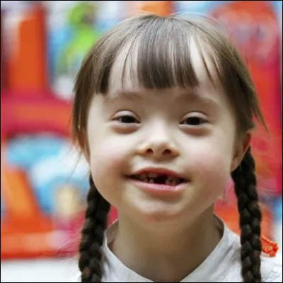 Comment s'appellent les petites taches blanches retrouvées fréquemment au niveau des iris des malades ?