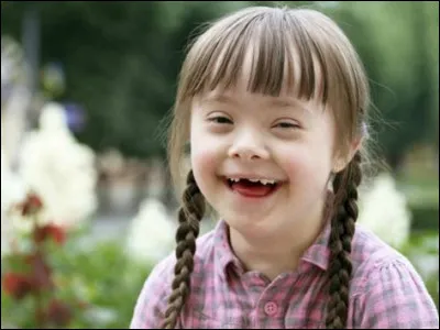 Dans les années 1970, quelle était l'espérance de vie d'un malade porteur de trisomie 21 ?