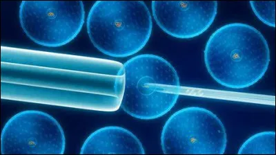 Quels sont les premiers symptômes du syndrome de Lafora ?