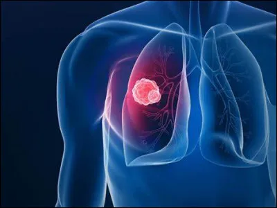 Depuis quelle année cette maladie figure-t-elle, en France, sur la liste des maladies infectieuses à déclaration obligatoire ?