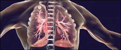 Comment la tuberculose est-elle surnommée lorsque de nombreux et minuscules nodules se disséminent ?