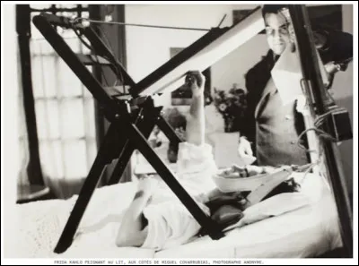 Frida Kahlo > La Mexicaine aura eu plus que son lot de souffrances, après un accident de bus à 19 ans : abdomen percé par une barre de métal ; jambe droite, bassin et colonne vertébrale brisés. Lors d'une ultime opération, ... (Complétez !)