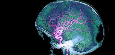 Ainsi, les troubles sont classés en plusieurs catégories : névroses, psychoses et perversions. Savez-vous quelles sont les principales différences entre névroses et psychoses ? Que signifie le terme de perversion psychologique ?