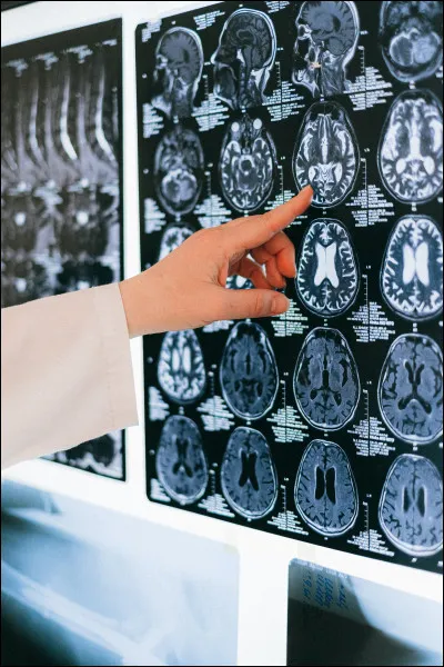 Dans une des propositions précédentes apparaît le terme de "détresse psychologique". Qu'est-ce que cela peut signifier ?