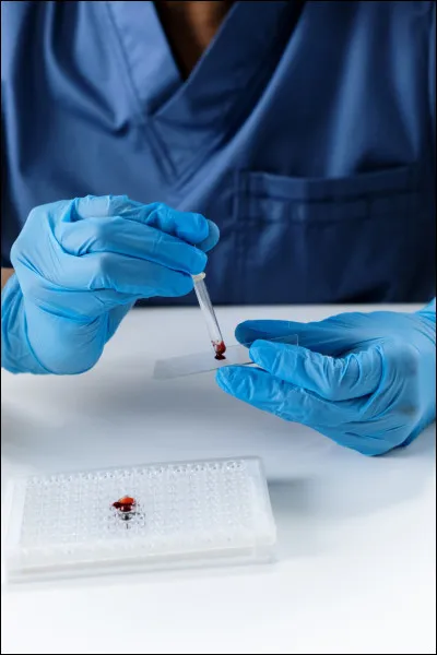 L'un des modèles les plus connus en psychopathologie est le modèle biologique. Comment le caractériseriez-vous ?