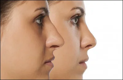 Comment est ton nez ?