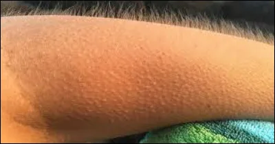 Avoir la chair de _.