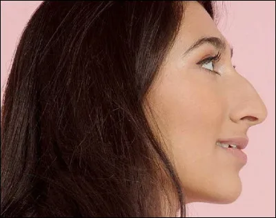 Quel est le nom de ce type de nez ?