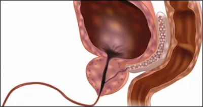 Quel est le nom du canal de sortie de la vessie ?