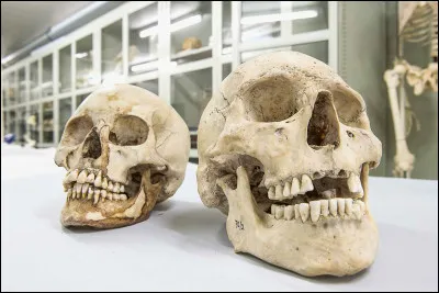 Peter prends à Harry...