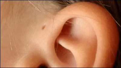 As-tu ce petit trou vers ton oreille comme sur la photo ?