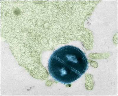 Les étapes de la phagocytose sont...