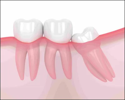 Les dents sont composées de...