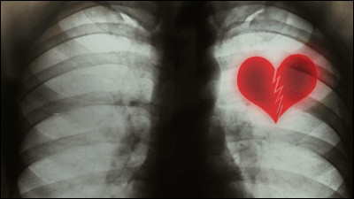 Qui chante "Best life" ?