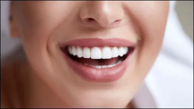 Comment dit-on "dents" en anglais ?