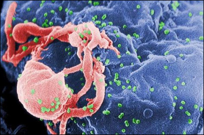 De quelle infection le SIDA est-il le dernier stade ?
