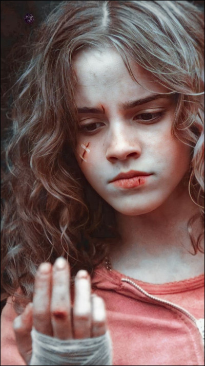 Quand a-t-elle une cicatrice sur la joue ?