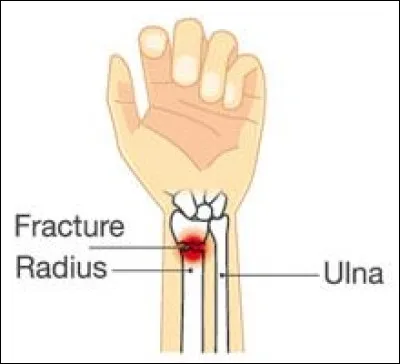 Dans "Astérix Gladiateur", souvenez-vous comment se nomme le serviteur du laniste (dresseur de gladiateurs) Caius Obtus, chargé de faire d'Astérix et d'Obélix des gladiateurs ?