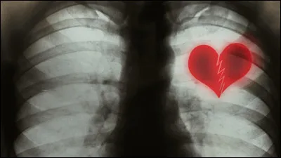 La drépanocytose est la maladie rare la plus répandue. Que touche-t-elle ?