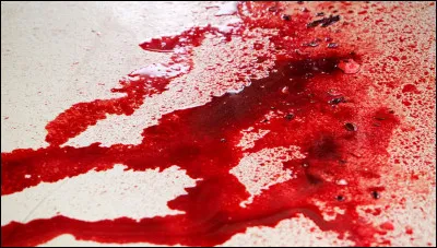 Complétez : Mon frère a la phobie du...