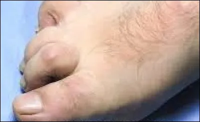 J'arrête de vous casser les pieds avec ce quiz mais, quel est donc le titre de l'album qui se cache dans mes deux propositions ?