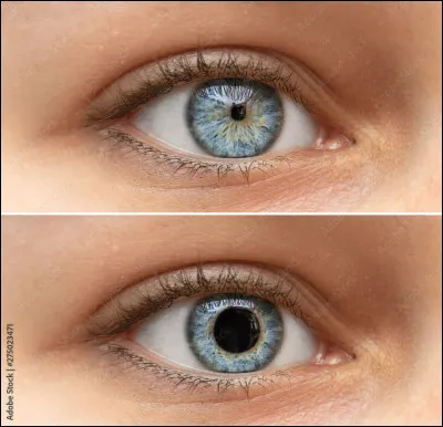 Donc pour conclure sur cela, quels types de sentiments peut-on éprouver lorsque nos pupilles sont rétractées ?