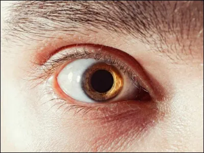 Parlons donc de la mydriase ! Mais... qu'est-ce donc ?