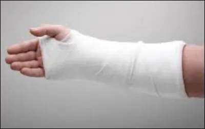 Ta sur sest cassé le bras et tes parents soccupent plus delle Comment régis-tu ?