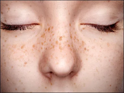 As-tu une particularité ?