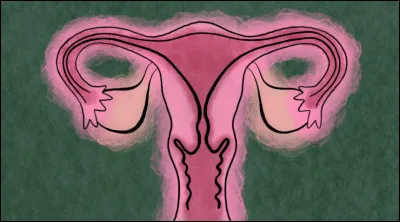Quel ensemble de conditions ci-dessous n'est pas lié à la menstruation ?