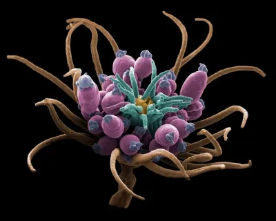 Echtopleura larynx appartient au même embranchement que les coraux, les anémones de mer et les méduses, a une apparence délicate et douce : quel est son petit nom, dans le langage de (presque) tous les jours ?