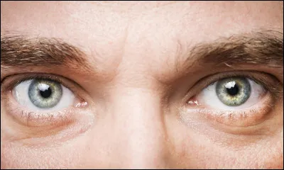 Le verre correcteur unique qui tient dans l'arcade sourcilière est...