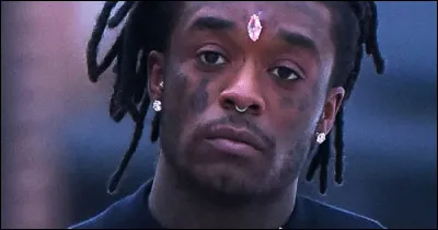 Quelle est la valeur du diamant que Lil Uzi Vert a fait implanter sur son front ?