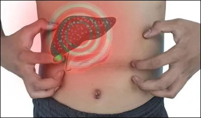 C'est le foie gras, très gras.